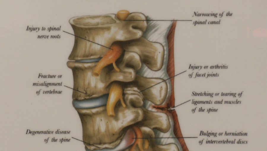 VEŽBAJTE SA NAMA: Fizikalna terapija za jaka leđa bez bola (VIDEO)